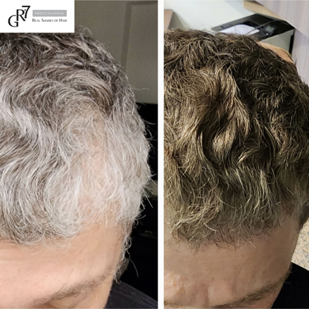 Before-After_gr7