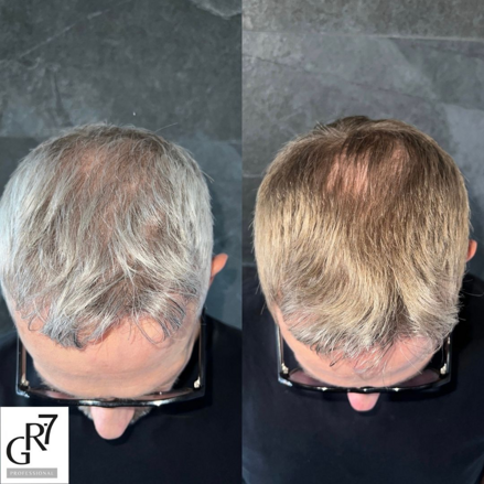 Before-After_gr7