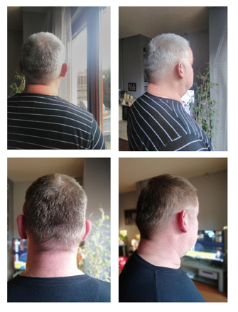 Before-After_gr7