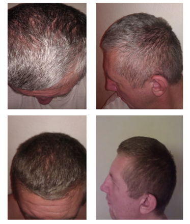 Before-After_gr7