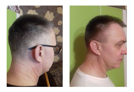 Before-After_gr7