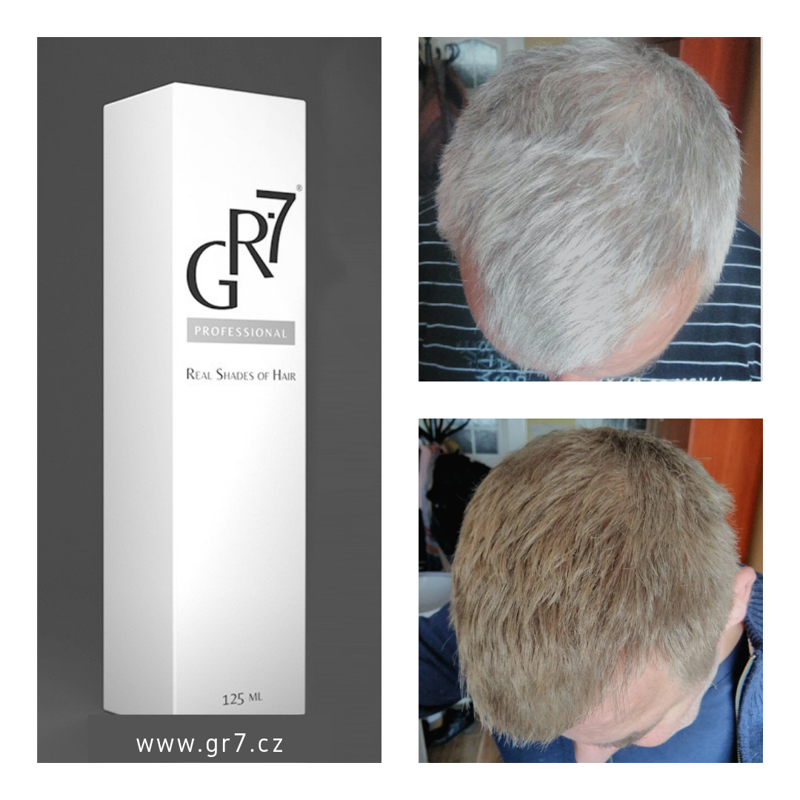 gr 7 gegen graues haar